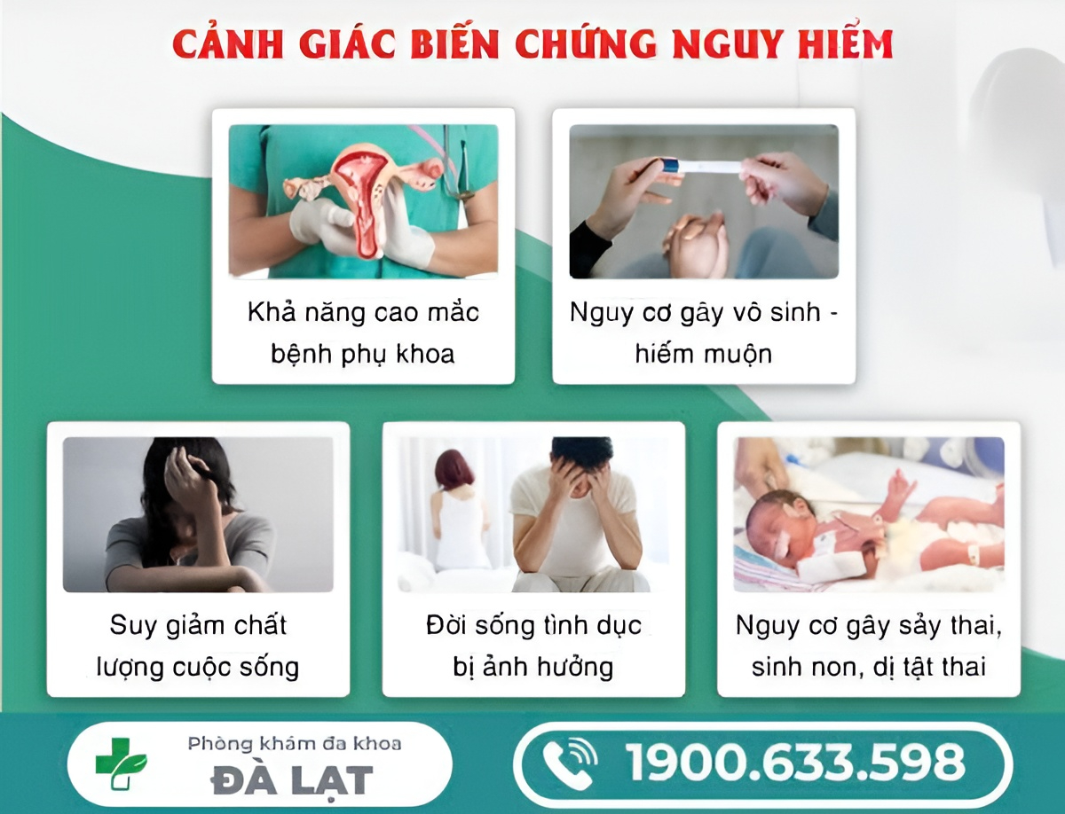 Hình ảnh minh họa